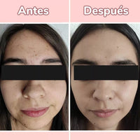 Envisha® Serum 4 en 1 antiarrugas y manchas