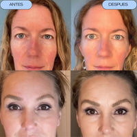 Dermawad Pro™ Tonificador facial|| 🔥Hoy 50% Off🔥