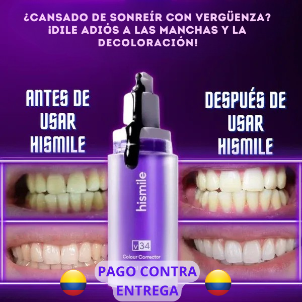 SMILE® CREMA DENTAL BLANQUEADORA 50% DE DESCUENTO