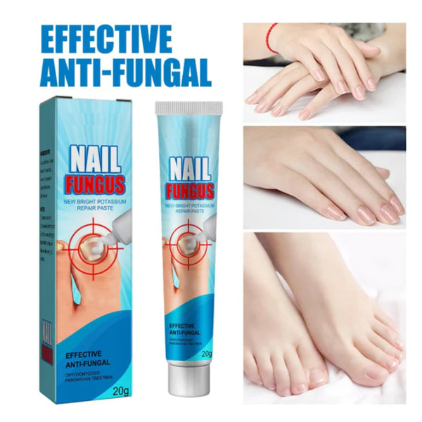 Fungus™ Crema hongos para uñas