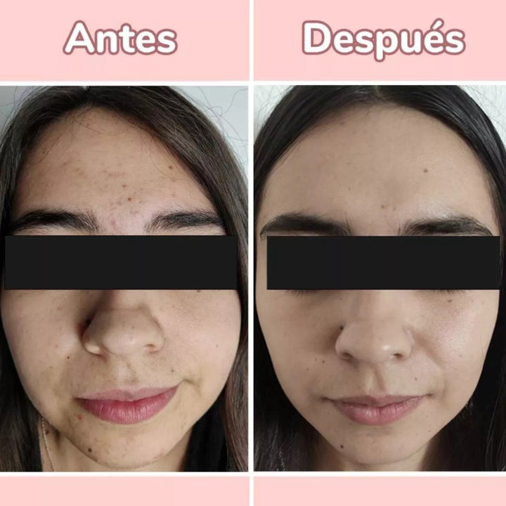 Envisha® Serum 4 en 1 antiarrugas y manchas