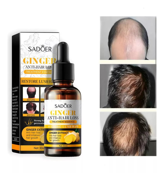 Sadoer Ginger™ Serum capilar anticaida