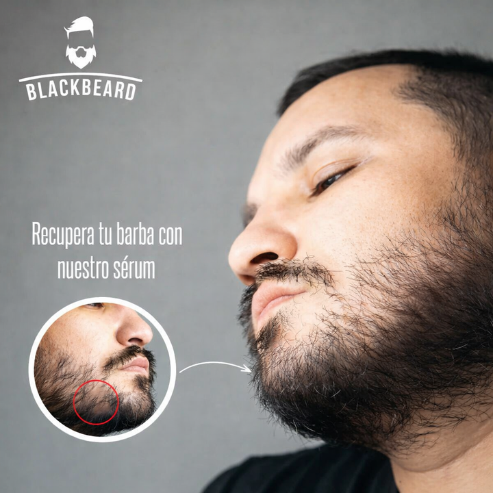 FollicleX™-Máxima Potencia para Barba y Cabello