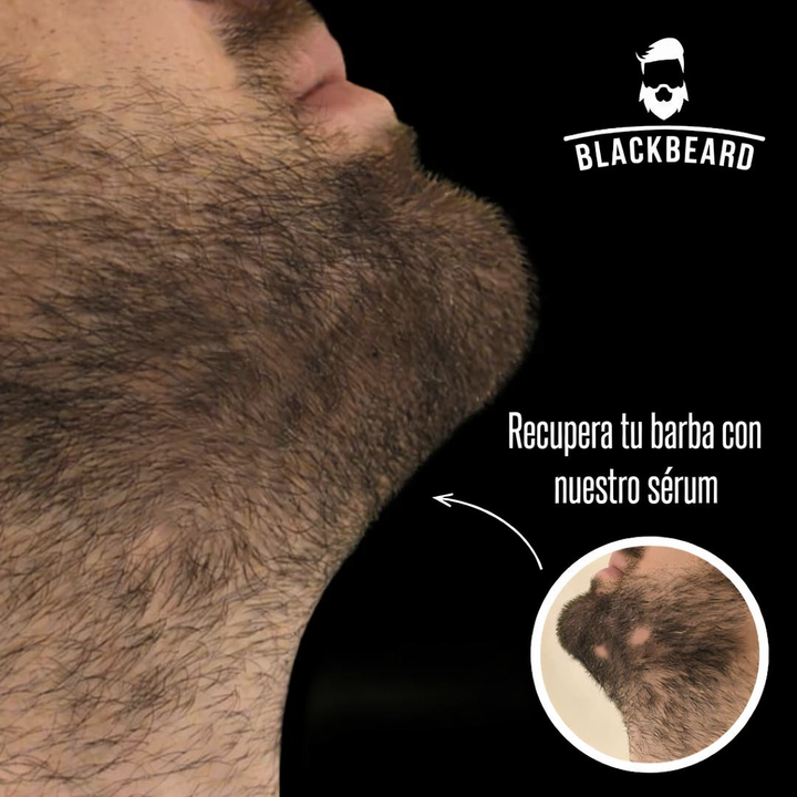 FollicleX™-Máxima Potencia para Barba y Cabello