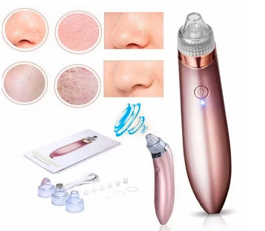 Absoglow™ Extractor de Espinillas y Puntos Negros||+Rutina Skincare de regalo🎁