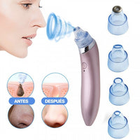 Absoglow™ Extractor de Espinillas y Puntos Negros||+Rutina Skincare de regalo🎁