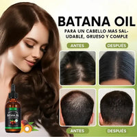 Batana Oil™ Detiene la caída y estimula el crecimiento del cabello ||🔥Promo 2 piezas🔥